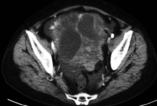 /uploads/image/2022-07-07/1344148932.jpg 2