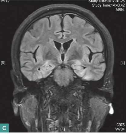 图1 头颅MRI-1813407954599149570
