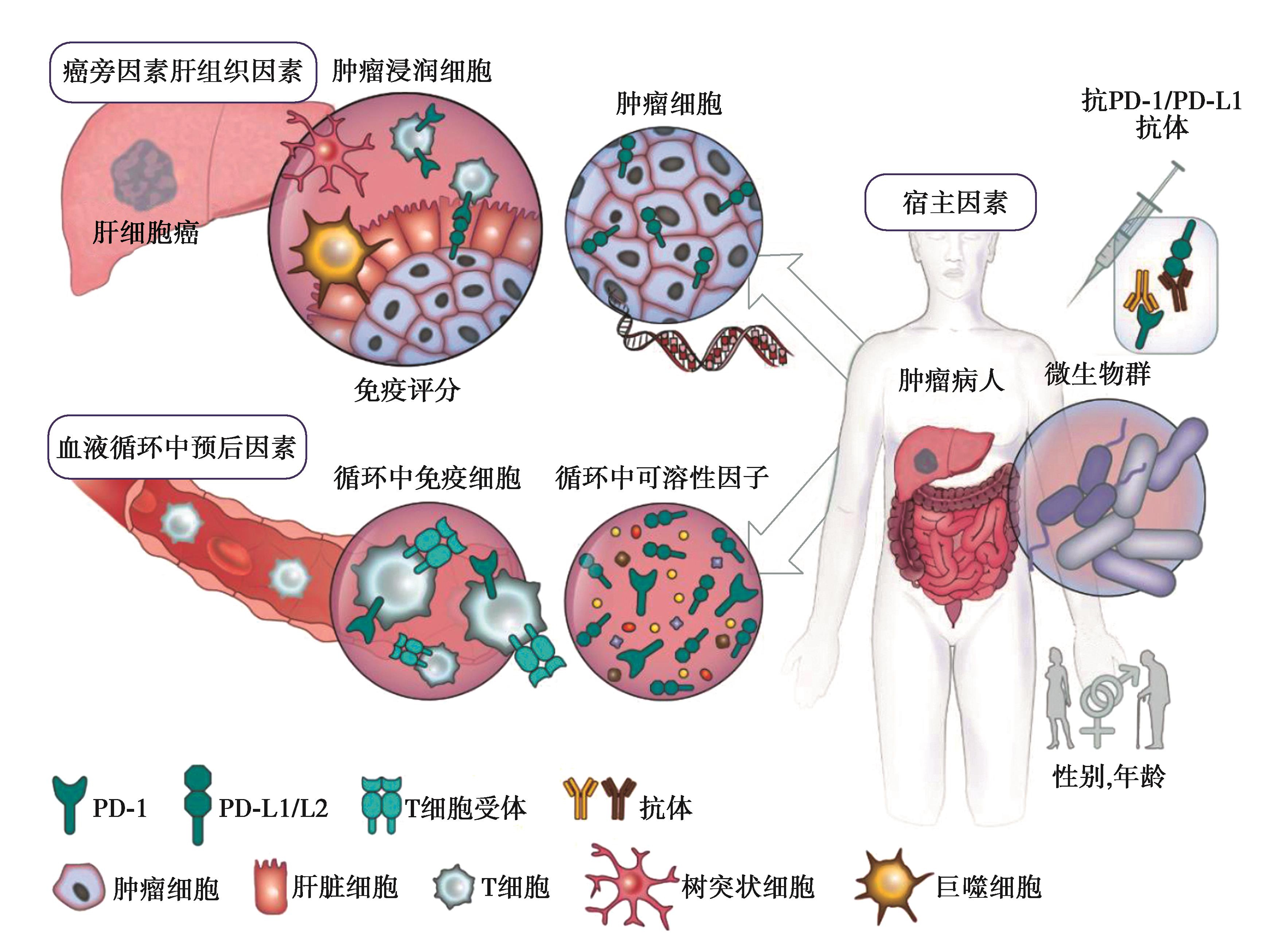 图4 HCCPD-1／PD-L1抑制剂疗效预测可能标志物概览