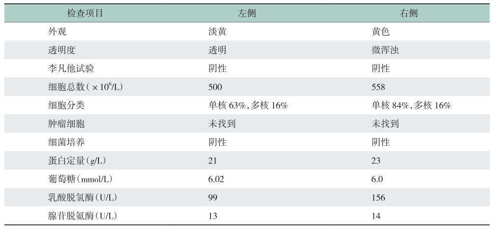 表2 胸腔积液检查结果