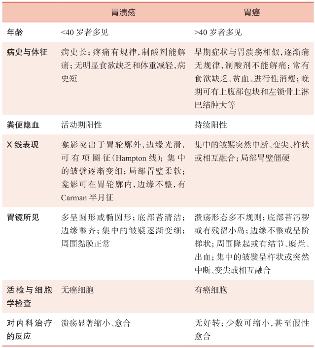 表1胃溃疡与胃癌的鉴别要点