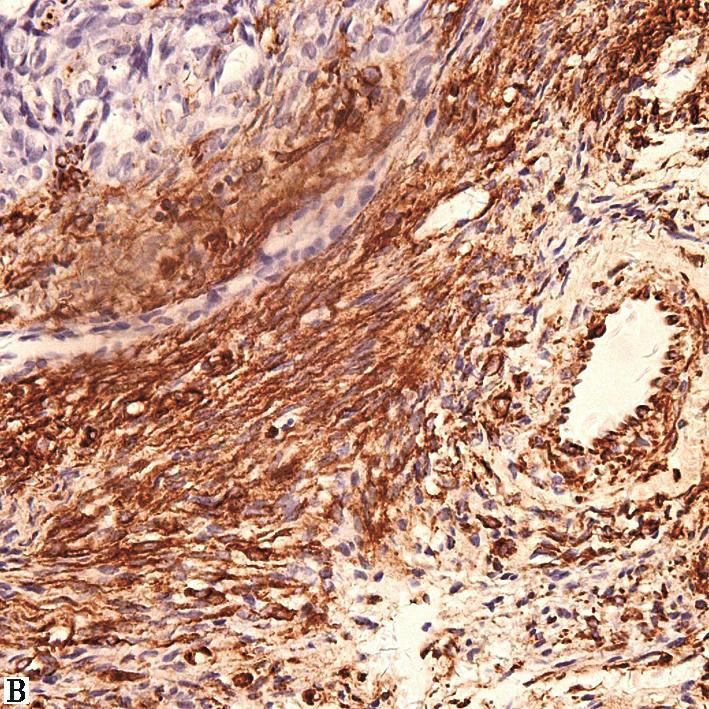 图5病理图像-7646130214520832