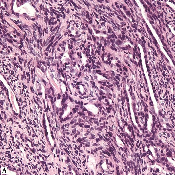 图5病理图像-7646139261093888